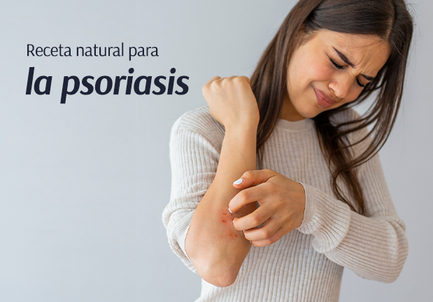 Receta natural para la psoriasis